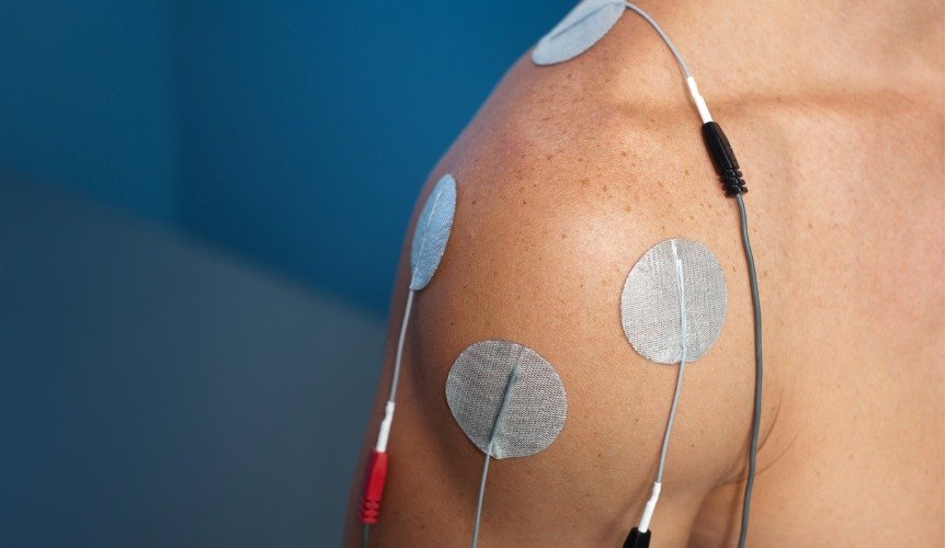 shoulder-electrical-stimulation-tens-picture-id471807793 تاريخ علاج الألم التداخلي: رحلة من الاكتشاف إلى التقدم